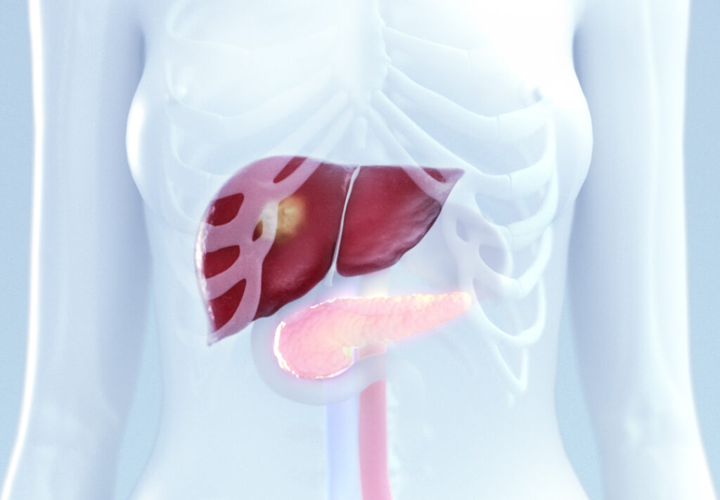 Science Liver Pancreatic Tumor Treatment Science Liver Pancreatic Tumor Treatment