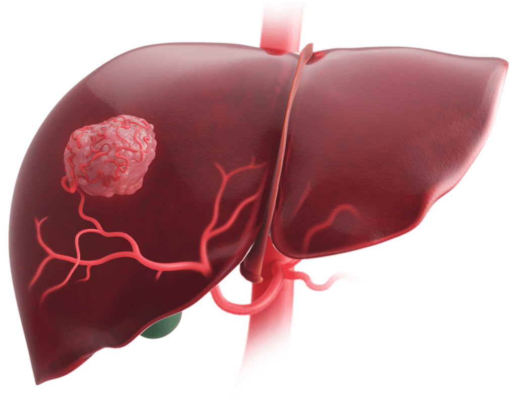 Science Liver & Pancreatic Tumor Treatment
