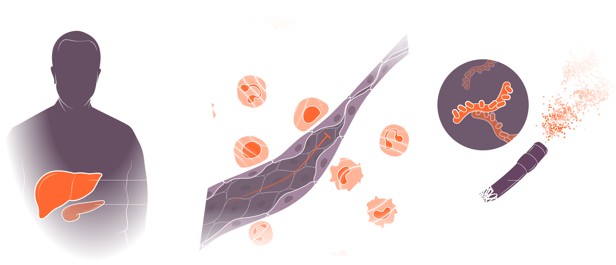 Illustration of the two organs, two problems, two solutions approach that TriSalus is working on. Two organs: the liver and pancreas in an elderly, male patient. Addressing two problems: immunosuppression and tumor pressure which causes blood vessel collapse. Combining two solutions: immunotherapy via pressure enabled drug delivery.